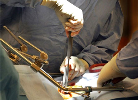 Wellington Spinal Unit Disc Surgery